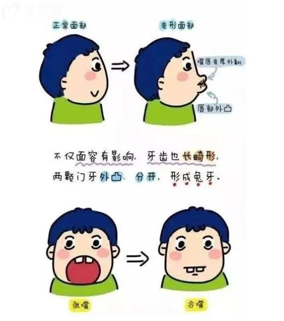 牙齒畸形