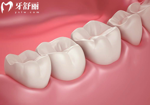 以色列雅定種植牙是什么檔次的