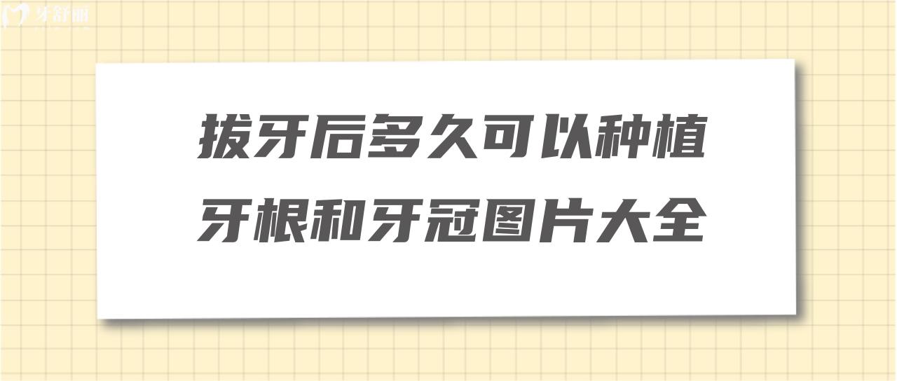 拔牙后多久可以種植牙根和牙冠圖片大全