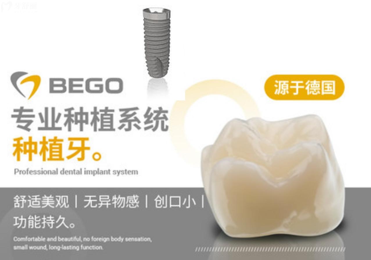 德國Bego種植牙