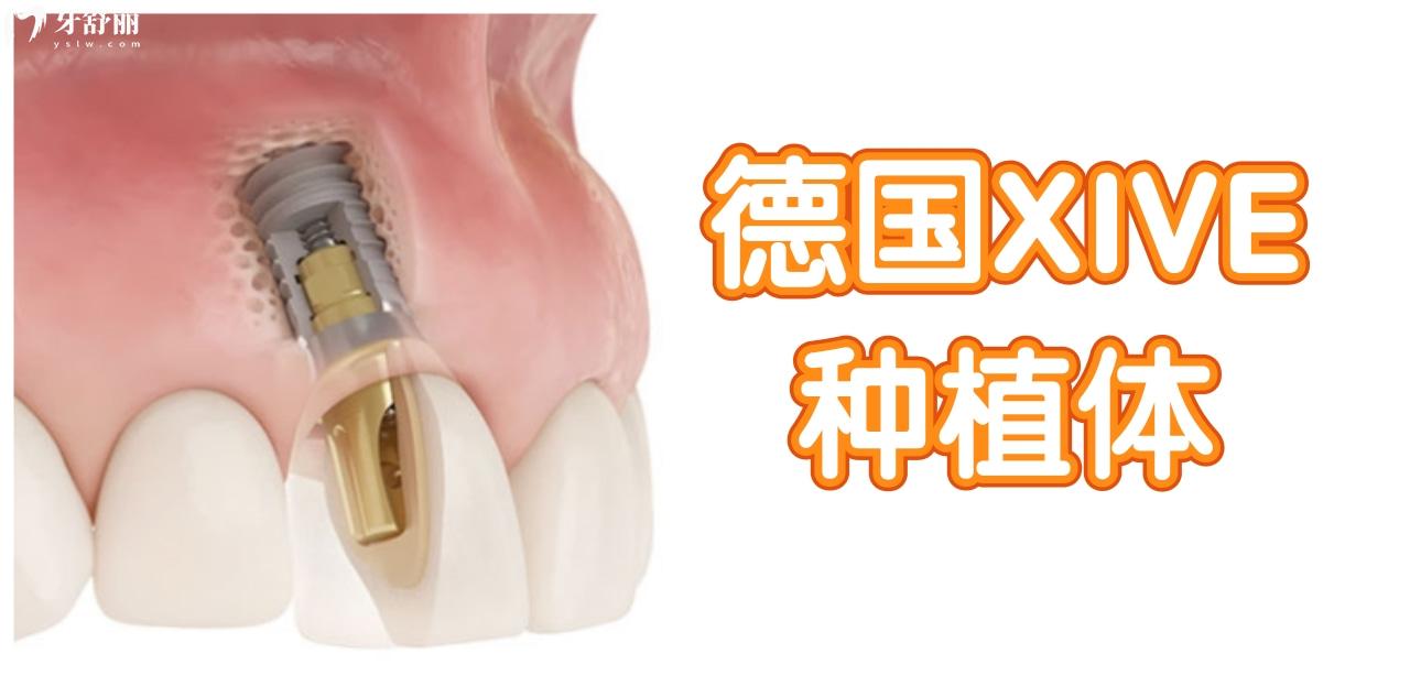 德國Xive種植體