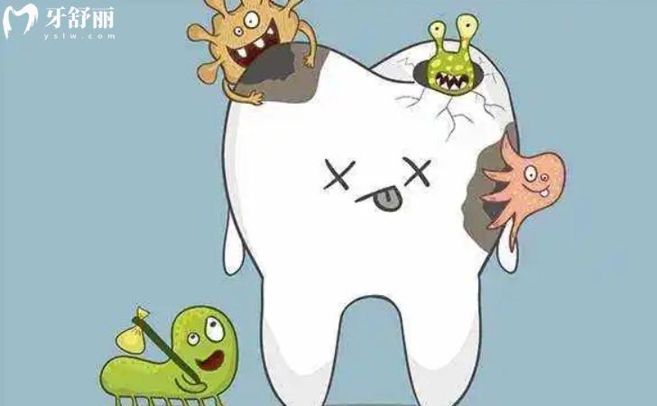 蛀牙卡通圖