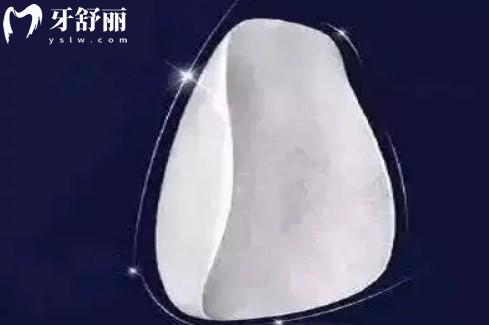 瓷貼面