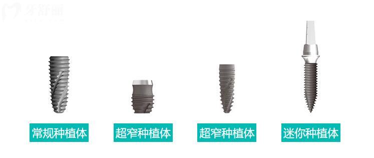 伊諾種植牙是哪個(gè)國 家的品牌
