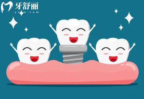 瑞士sic種植牙是幾級鈦