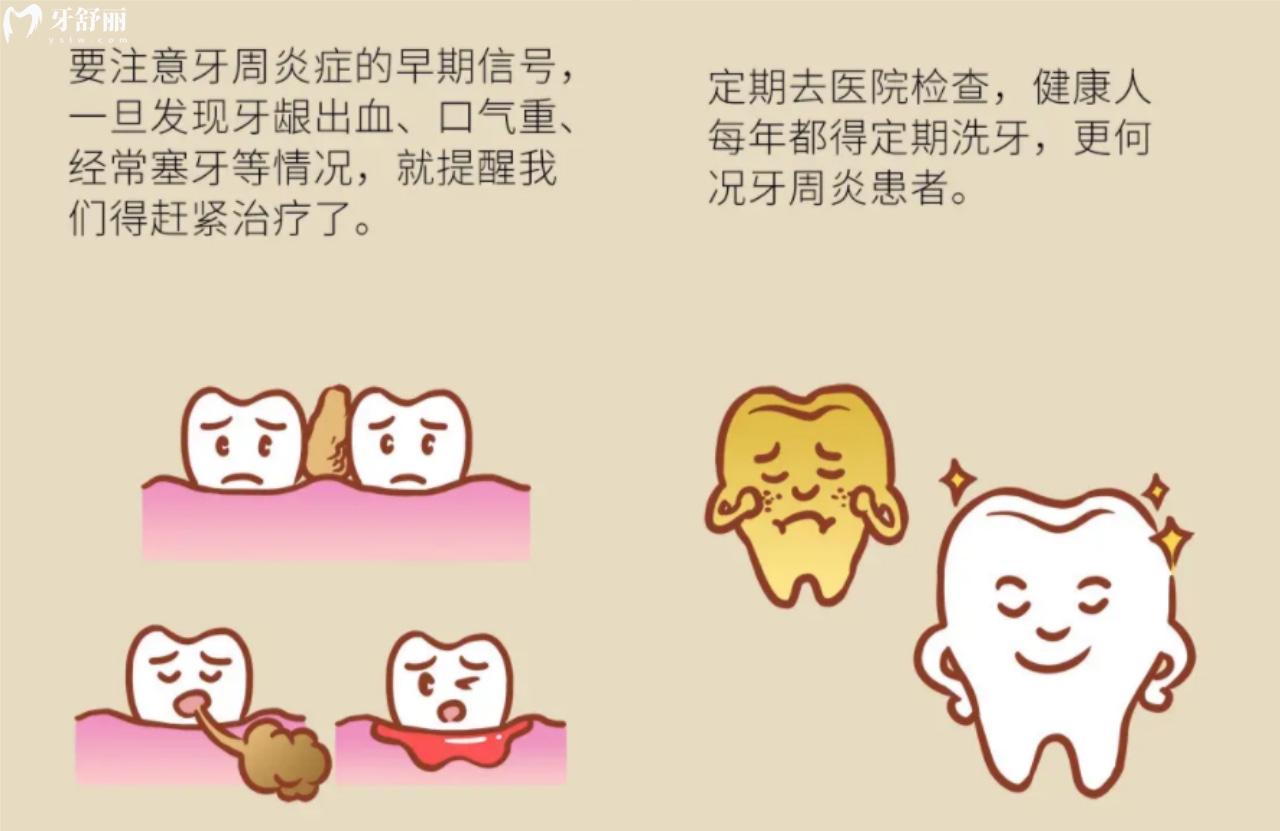 牙周炎有哪些早期癥狀