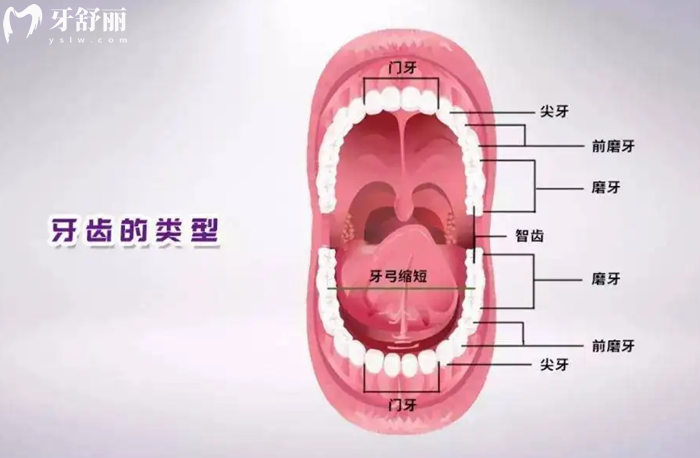 牙齒的類型