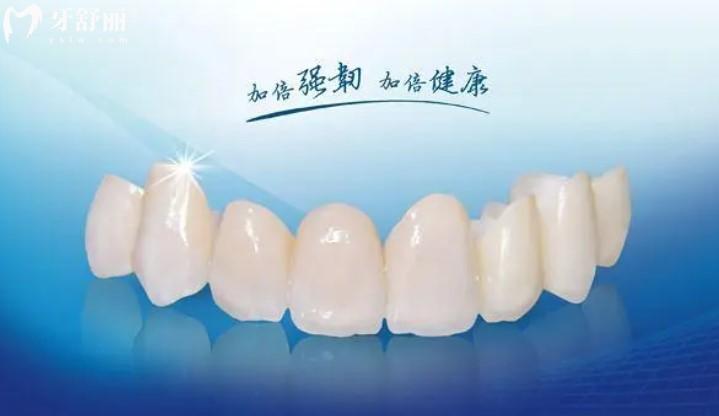 國產(chǎn)愛爾創(chuàng)全瓷牙
