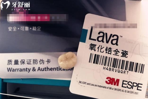 美國拉瓦全瓷牙