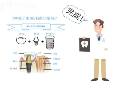種牙必看！重慶種植牙好且正規(guī)醫(yī)院排名前十名單及收費(fèi)價(jià)格表