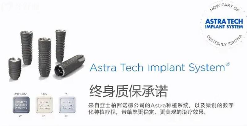 瑞典astra種植體