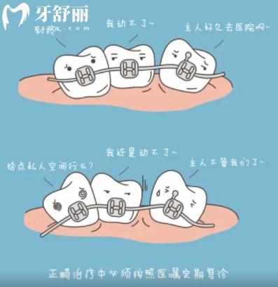 牙齒矯正會變牙套臉？帶牙套1~12月變化圖