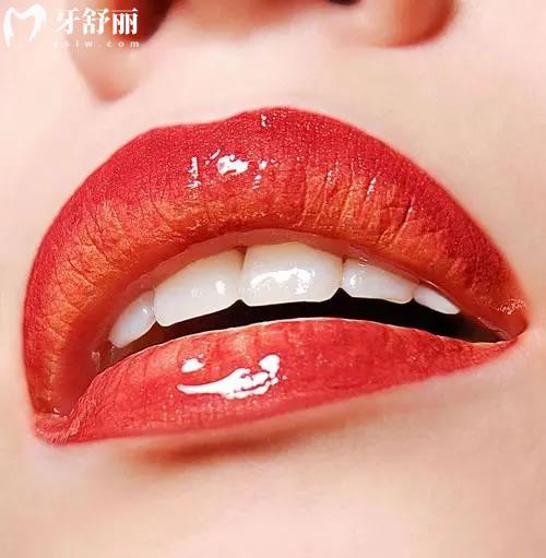 人的牙齒都是上下合不上的嗎圖片解答，附危害與判斷！