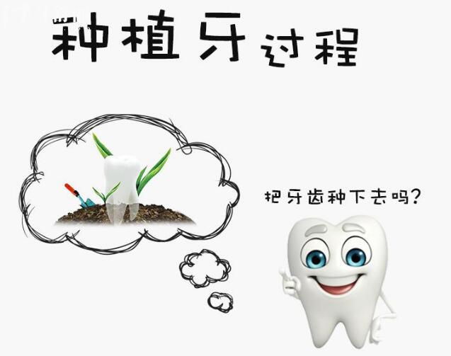 美國種植牙多少錢一顆?美國種植體常見的都有什么品種.jpg