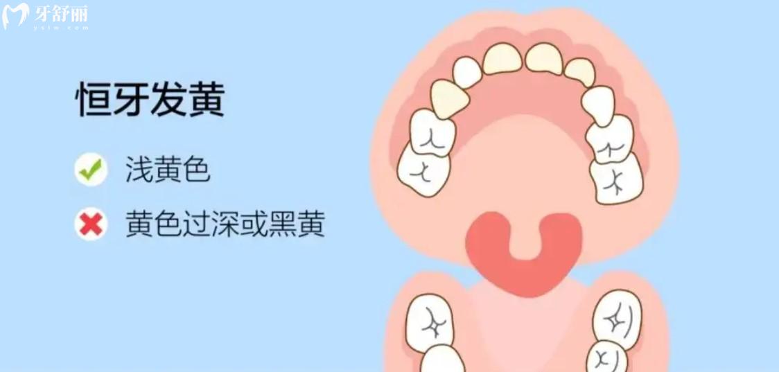 恒牙圖片