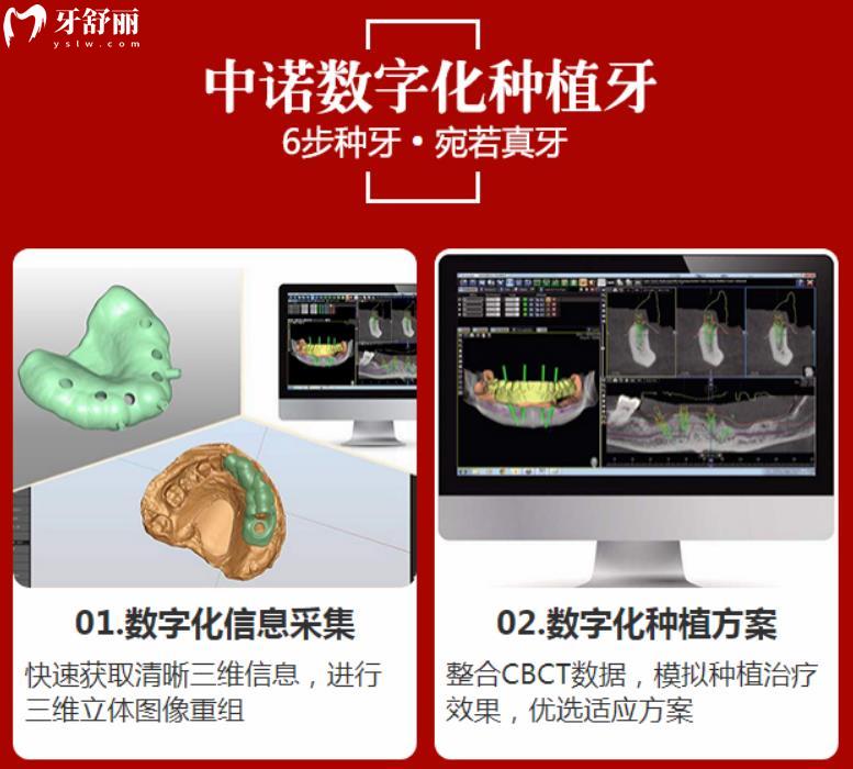 中諾口腔數(shù)字化種植