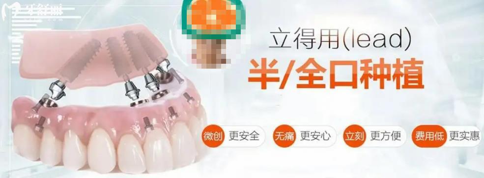 立得用種植牙優(yōu)勢