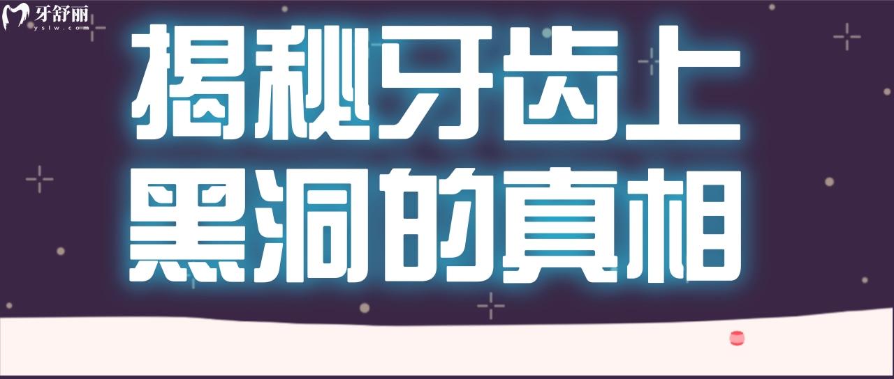 牙齒上黑洞的真相 探究牙上黑洞里面到底有什么看圖片