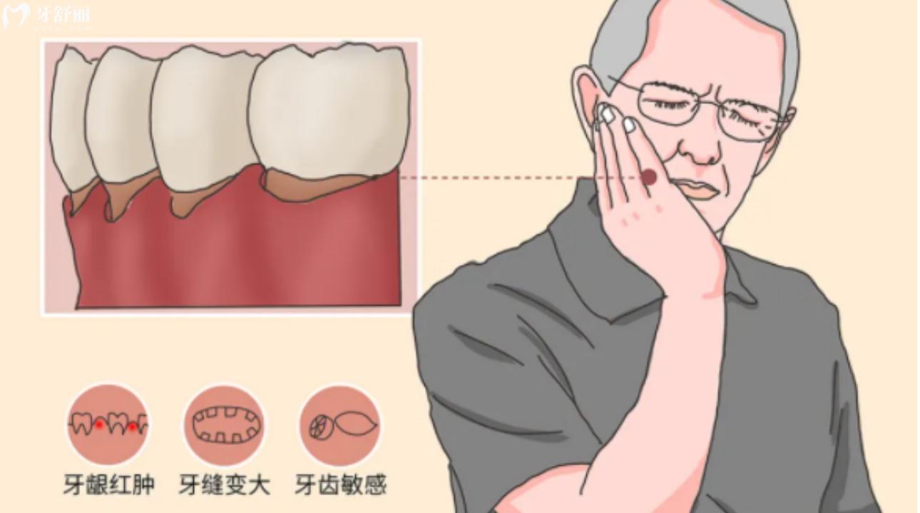 牙齦萎縮牙根外露怎么治療?什么原因造成的?