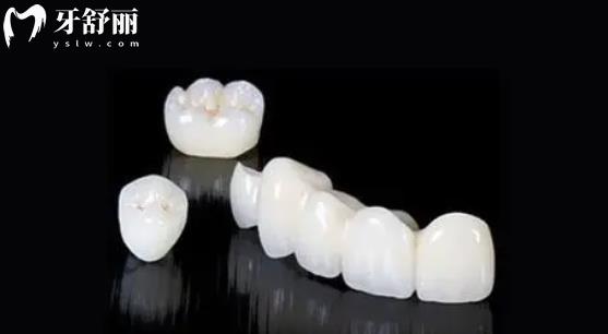 種植牙牙冠國產(chǎn)還是進口的好 牙科中常用的牙冠品牌有哪些？