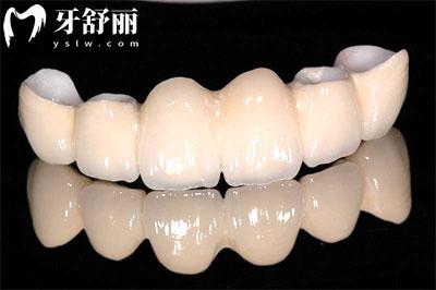 22-23年全新版上海牙科收費標準一覽 包含洗補拔整種牙價目表