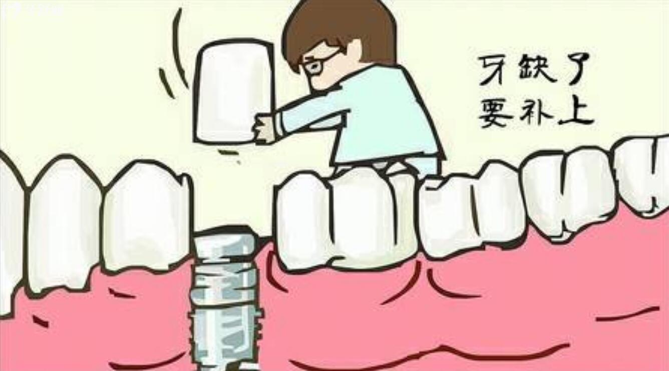 為什么后牙缺失也需要修復(fù)一下?后牙缺失不修復(fù)會有什么危害