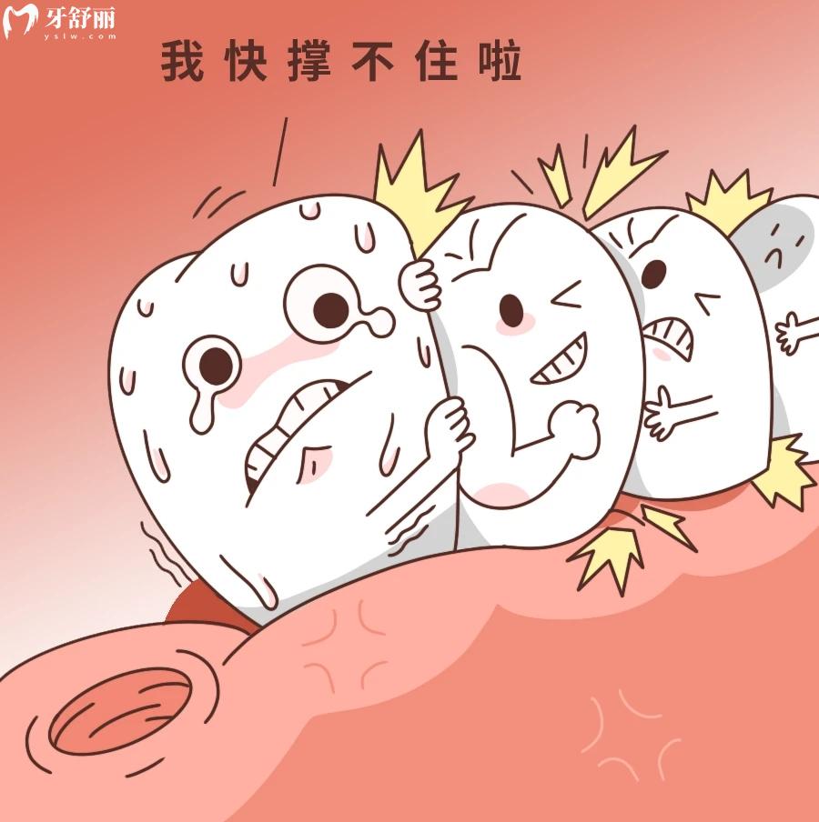 不注意護(hù)理，將近2W的種植牙失敗了后悔一輩子