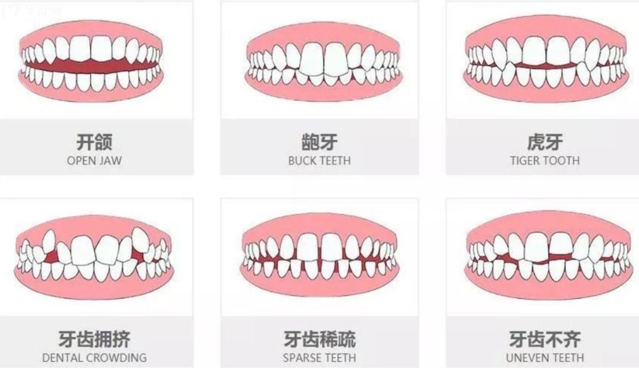 矯正牙齒去醫(yī)院好還是口腔診所好.jpg