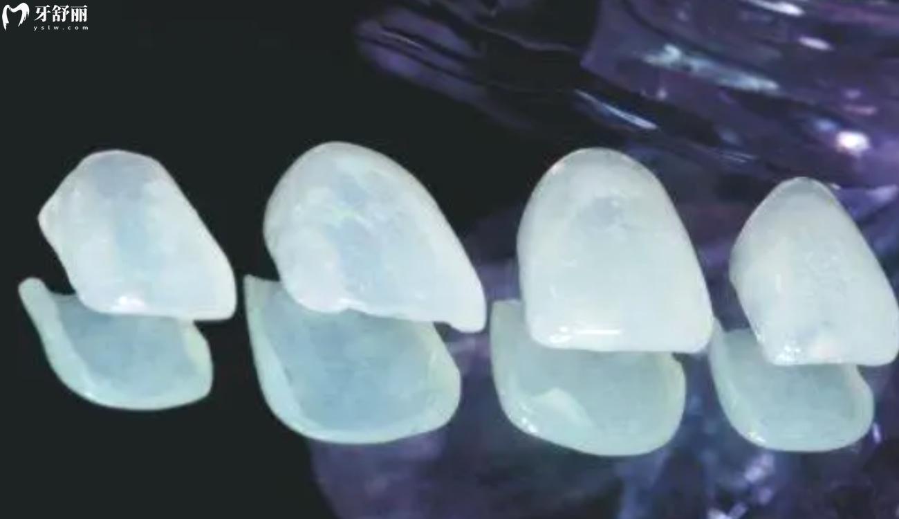 廣州牙貼面價(jià)格多少錢(qián).jpg