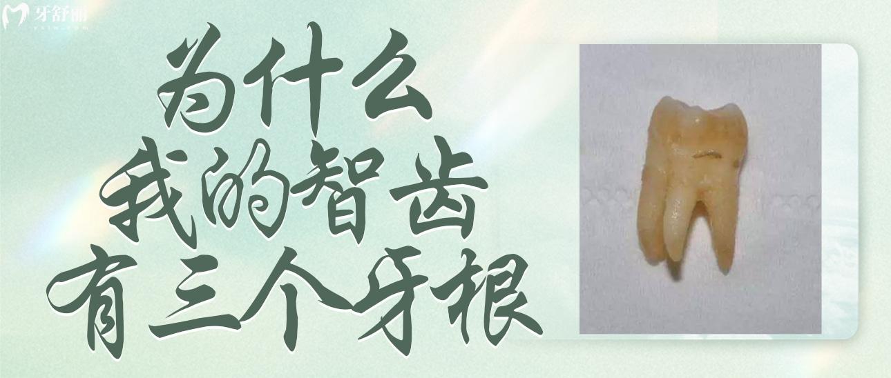 為什么我的智齒有三個牙根呢？正常嗎？