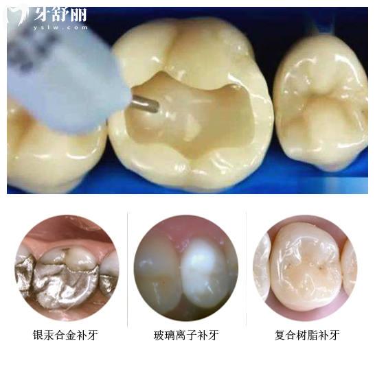 常州牙科醫(yī)院收費標準