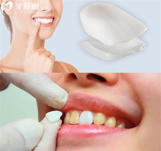 常州牙科醫(yī)院收費標準