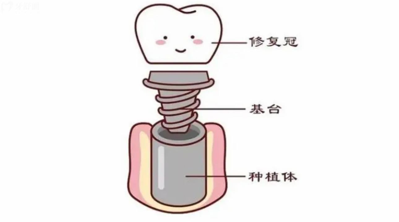 深圳薈悅城口腔診所怎么樣?聽說看牙價不貴？