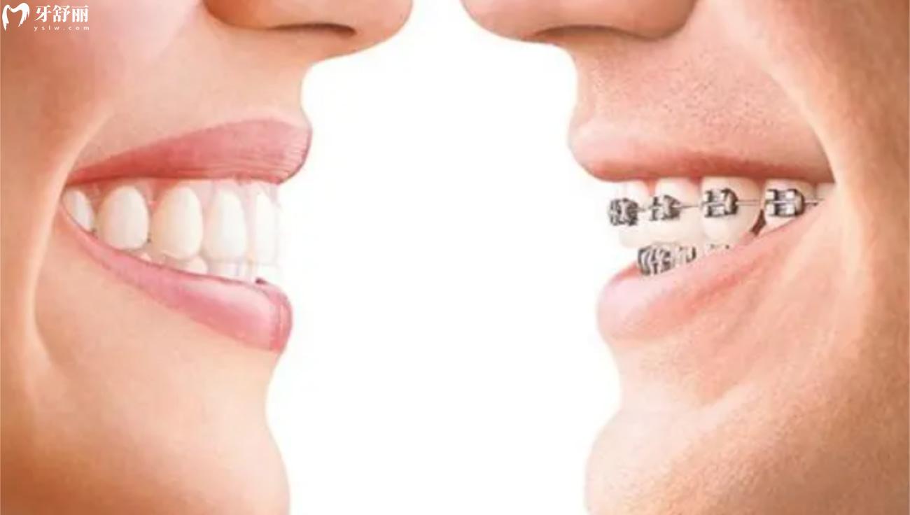 寧波口腔醫(yī)院收費(fèi)標(biāo)準(zhǔn).jpg