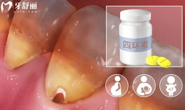 為什么每天認(rèn)真刷牙牙齒還不會(huì)變白？有什么解決辦法？