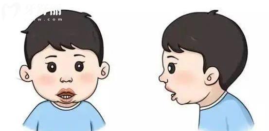 牙科中兒童顏面管理都是什么 提早干預(yù)重要嗎？