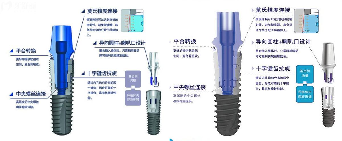 濟(jì)南種植牙多少錢一顆 濟(jì)南牙科23年新版價(jià)目表更新 