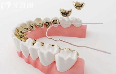 全新保定口腔收費(fèi)標(biāo)準(zhǔn)表格公布 包含洗/種/拔/補(bǔ)/整牙價(jià)目