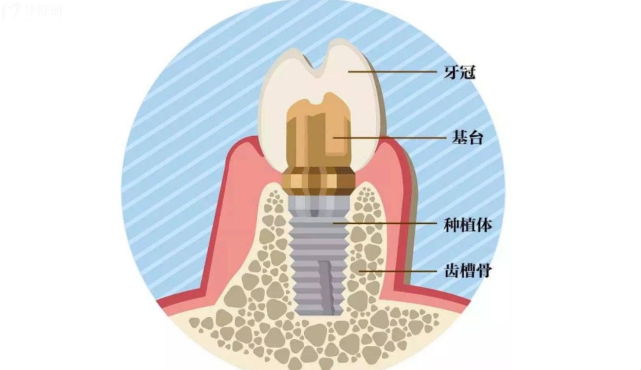 邢臺牙科收費(fèi)價目表揭曉.jpg