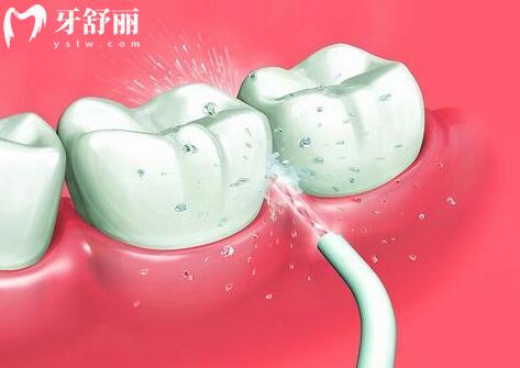 牙齦腫了個包是什么情況？能用手?jǐn)D嗎？