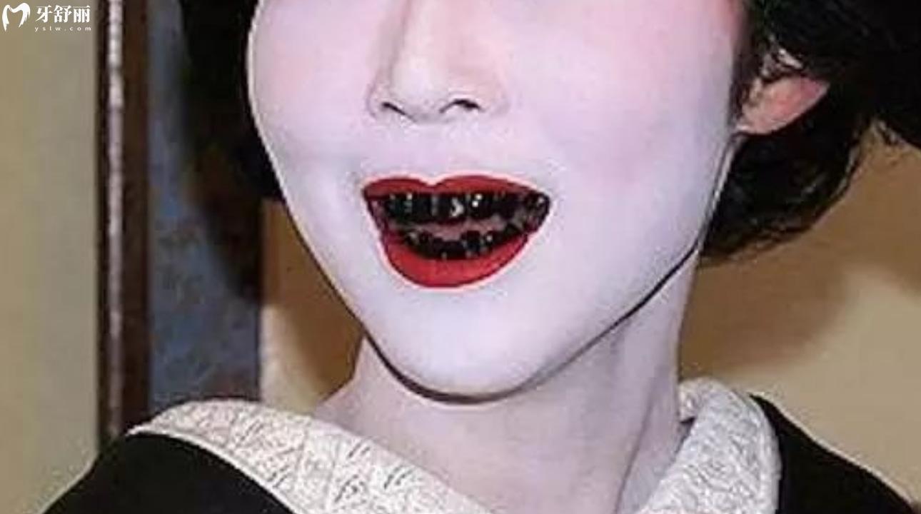 日本黑牙文化的特點 聽說有染牙的習俗是真的嗎?