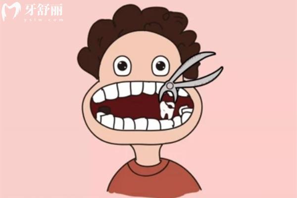 松動牙拔除卡通圖