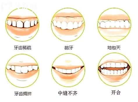 上海長寧區(qū)口腔醫(yī)院牙齒矯正