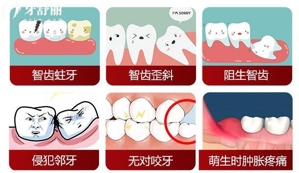 上海長寧區(qū)口腔醫(yī)院拔牙