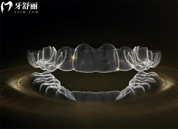 時代天使隱形矯正