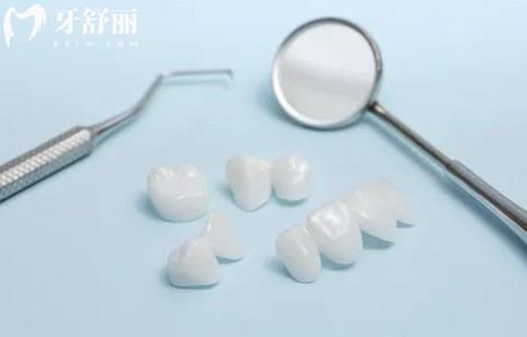 撫州英倫口腔醫(yī)院烤瓷、全瓷牙冠價格是多少