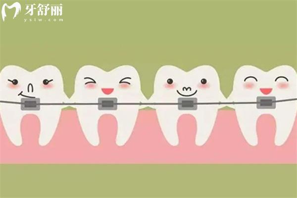 牙齒矯正