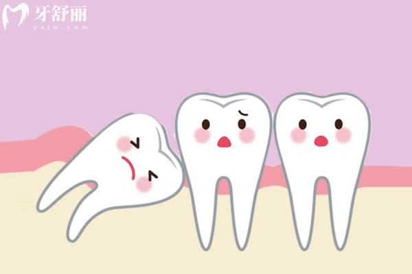 濟(jì)寧拔智齒多少錢一顆