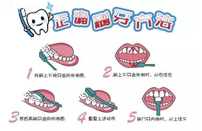 刷牙出血是什么原因引起的?保護口腔衛(wèi)生的四種方法要牢記
