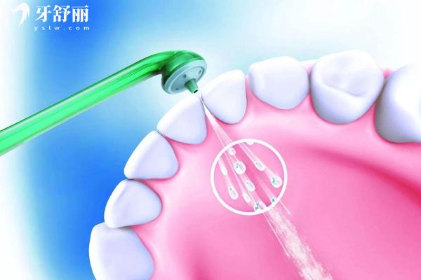 寧波洗牙多少錢一次